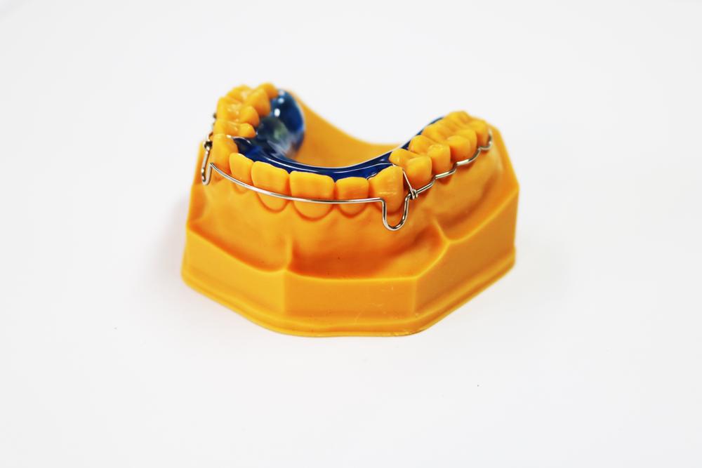 Beagle surround retainer