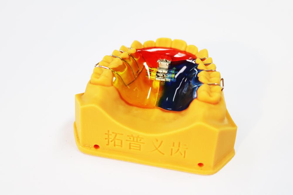 Three Way Palatal Expander