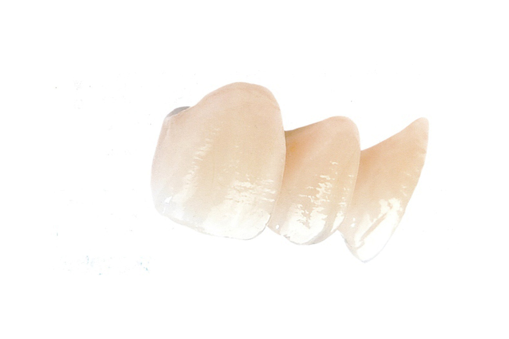 Layered Dental Zirconia Crown And Bridge Translucency 3D PRO