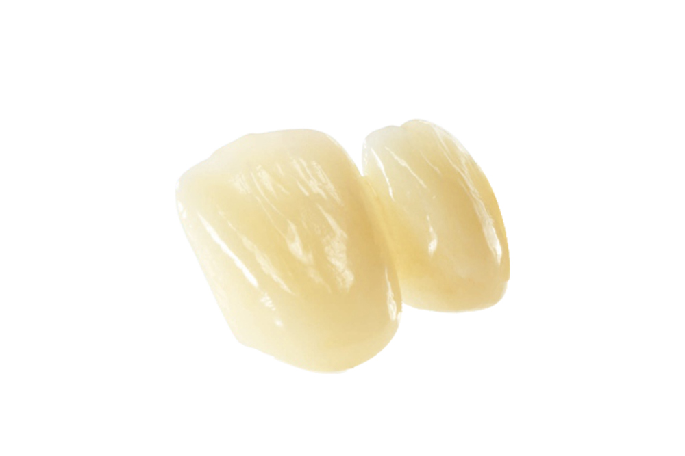 Layered Dental Zirconia Crown And Bridge