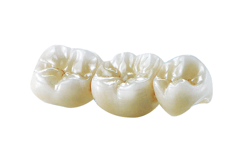 Full Contour Dental Lab Crowns High Translucency Solid Zirconia Crown