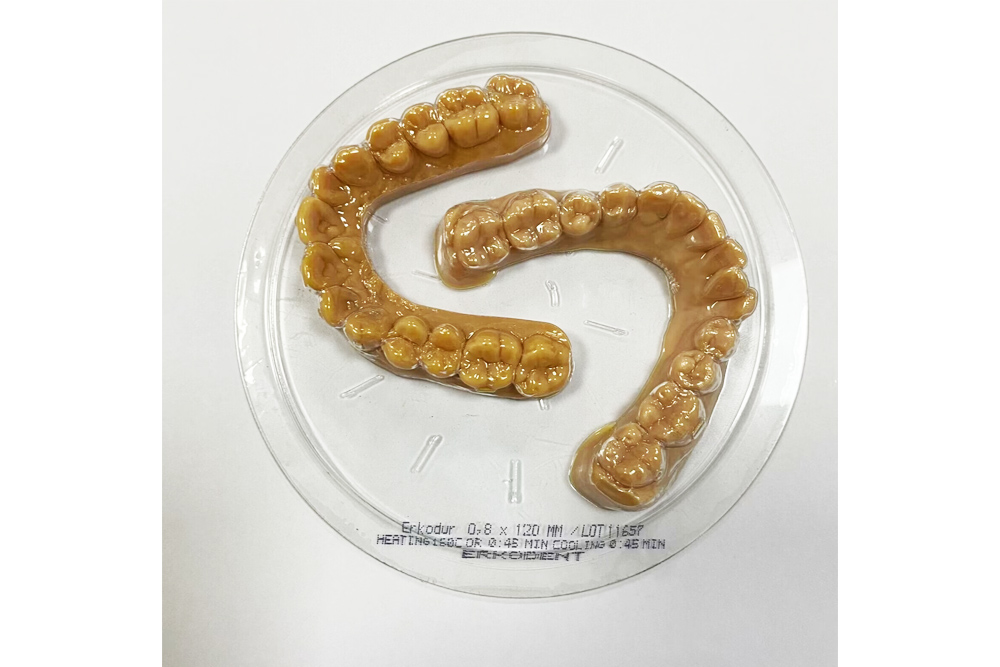 Clear Aligner Teeth Straightening
