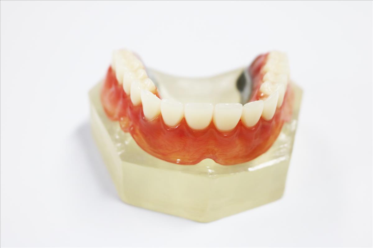 High Esthetics Full Acrylic Denture