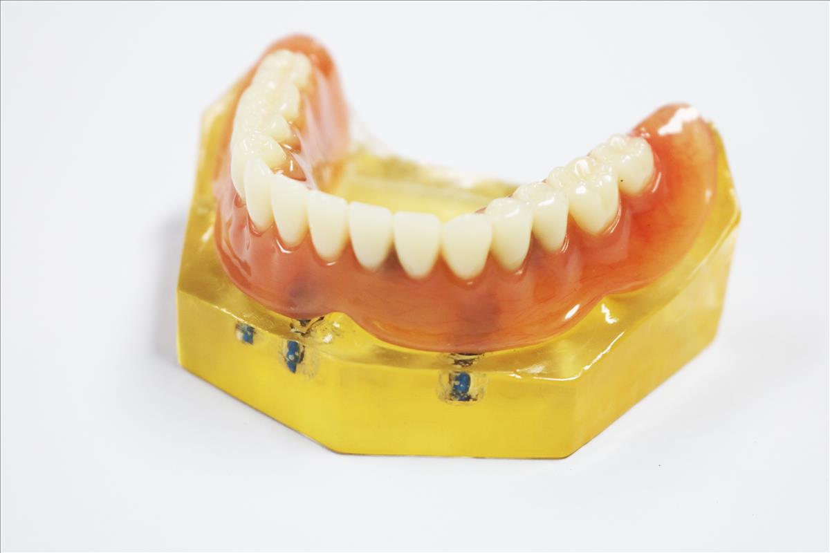 High Esthetics Full Acrylic Denture