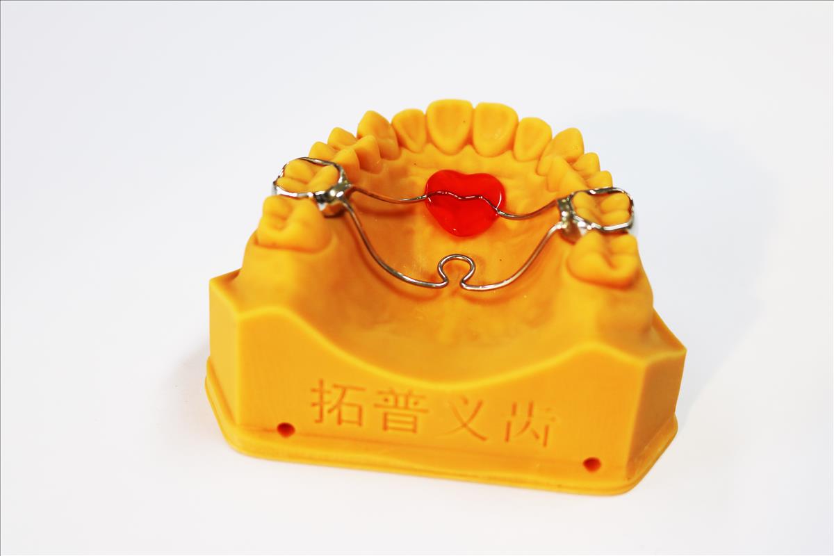 Combined Nance palatal support