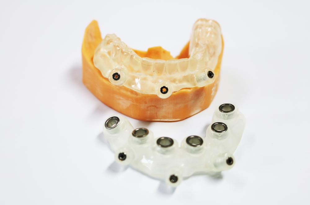 Digital implant guide plate for edentulous jaw