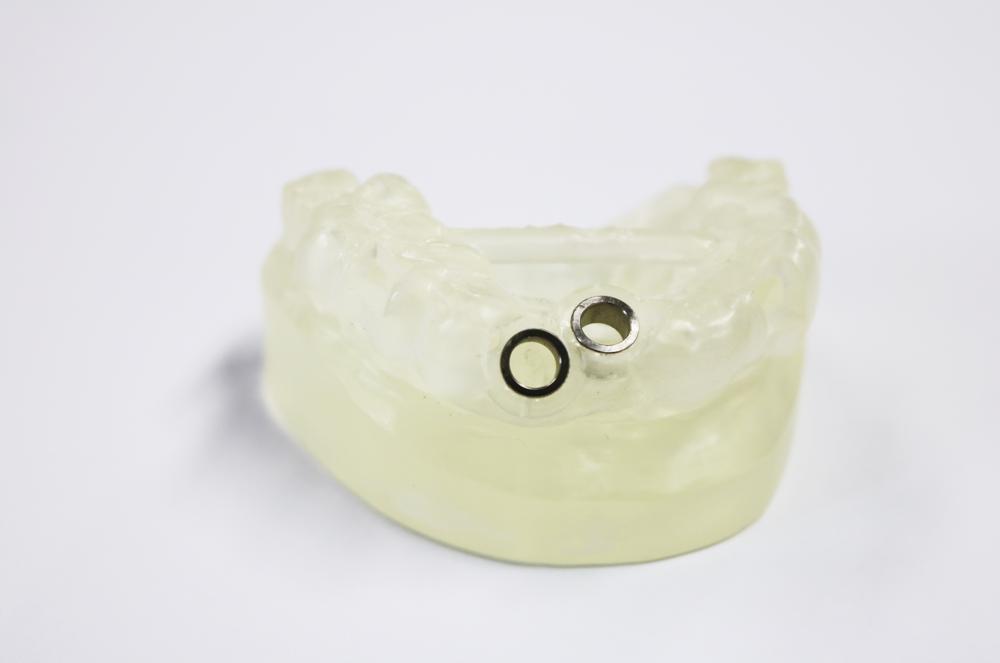 Digital implant (dental support) local half course guide plate