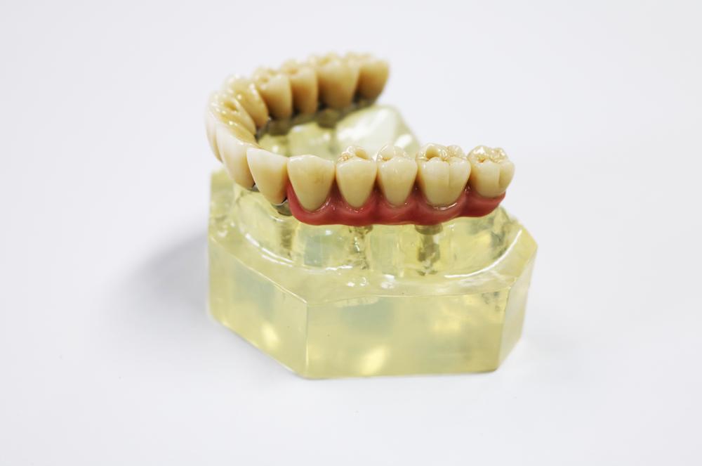 Zirconia Dental Implant Crown Biocompatible With Titanium Bar