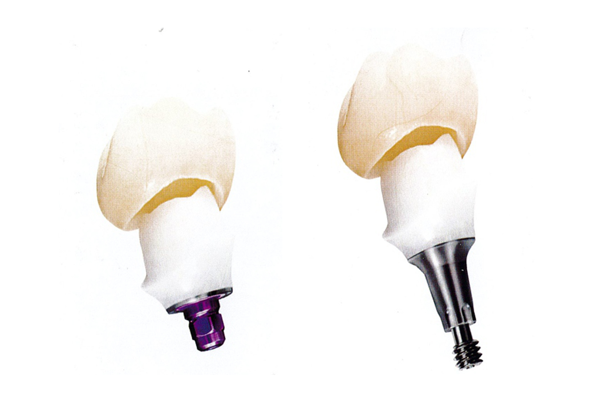 Dental Implant Crown Titanium Teeth Zirconia Crowns