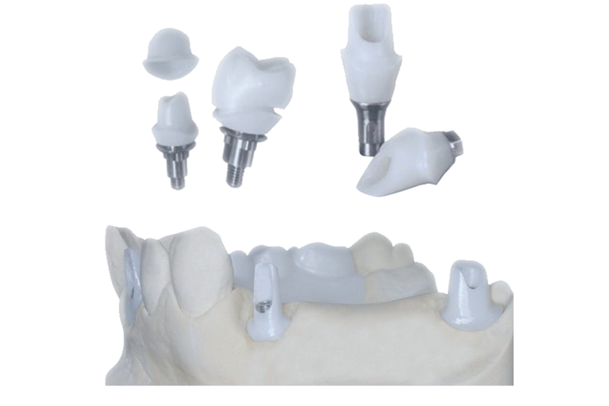 Dental Implant Tibase Zirconia Abutment Titanium Accuracy Customized