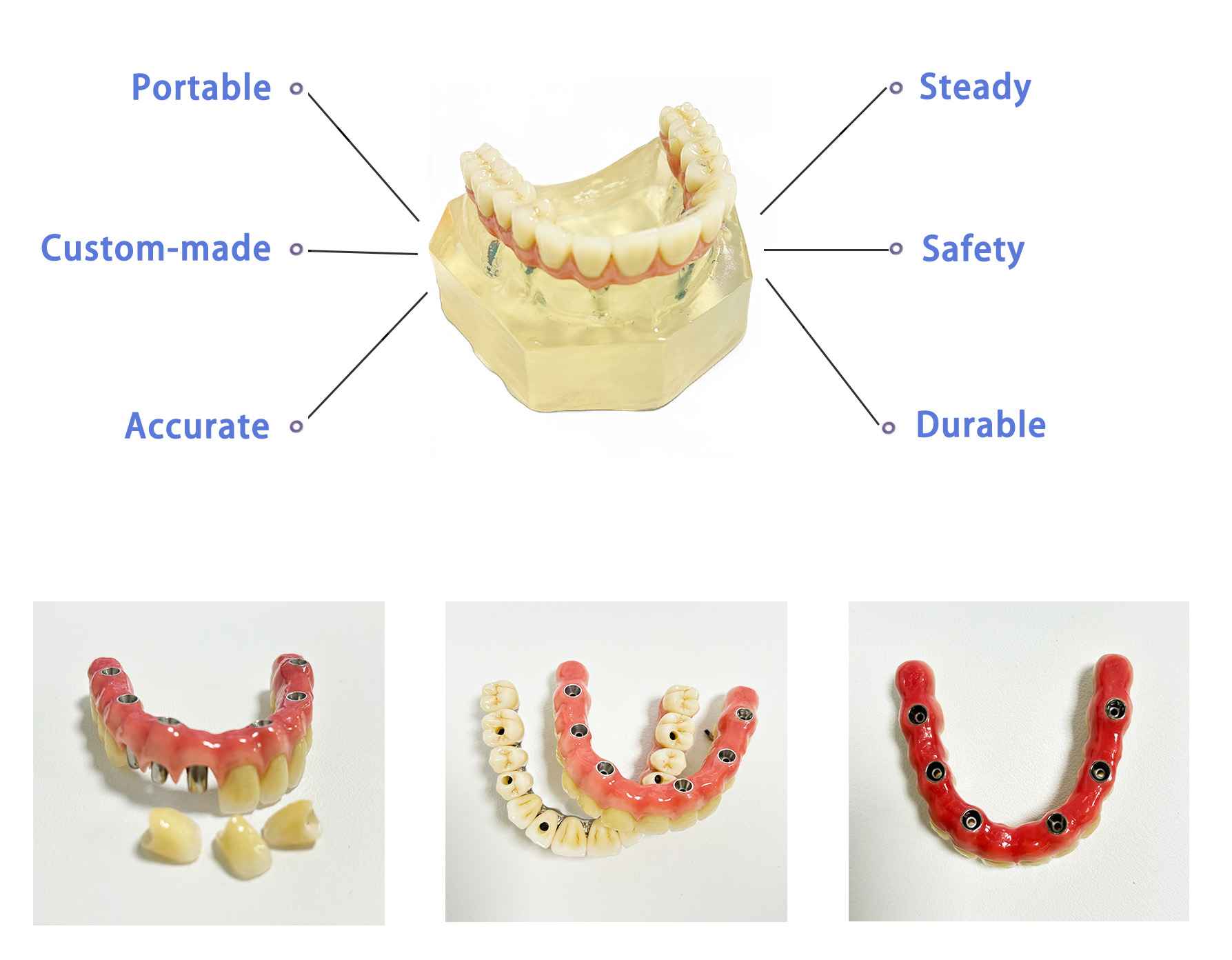Dental Implants