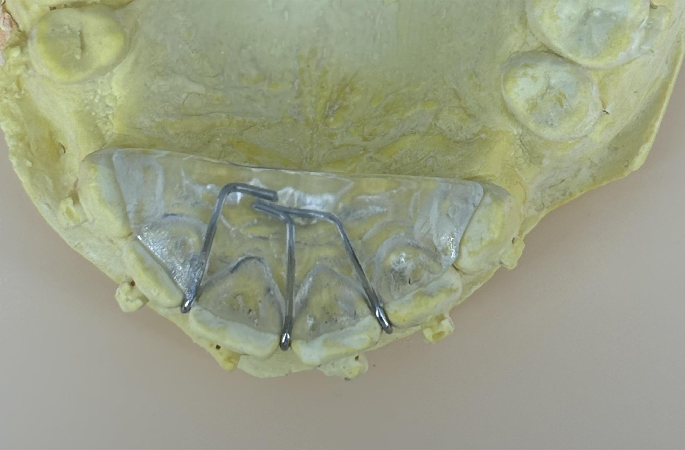 Flat bite plate