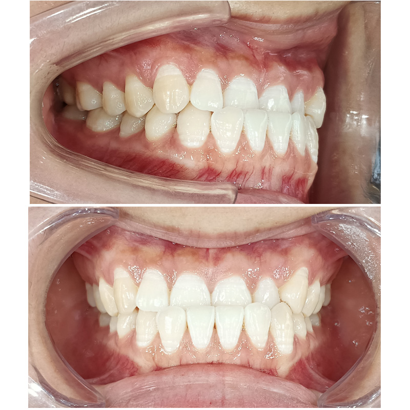 OR-20231014- ORTHO Analysis&Design Report