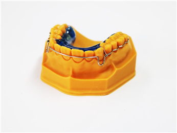 Beagle surround retainer
