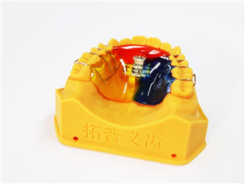 Three Way Palatal Expander