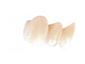 Layered Dental Zirconia Crown And Bridge Translucency 3D PRO