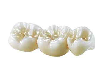 Full Contour Dental Lab Crowns High Translucency Solid Zirconia Crown