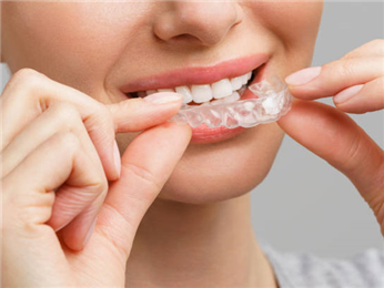Stable Teeth Alignment Correction Dental Clear Aligner Teeth Straightening