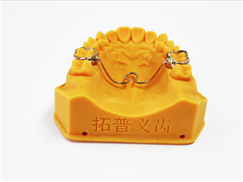 Transverse palatal bar/PTA palatal bar