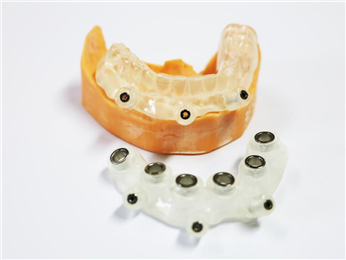 Digital implant guide plate for edentulous jaw