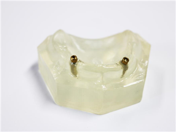 Dental Implant Locator Abutment