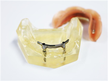 Implant the upper pure titanium rod card holder attachment Removable Denture
