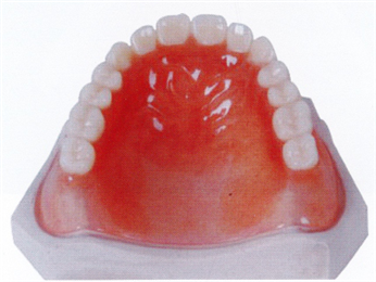Milled Full Acrylic Denture 3Shape Exocad CAD CAM Digital Complete Dentures