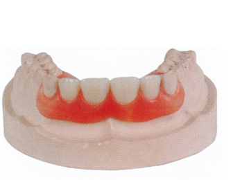 High Esthetics Full Acrylic Denture