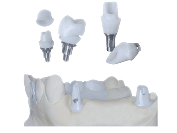 Dental Implant Tibase Zirconia Abutment Titanium Accuracy Customized