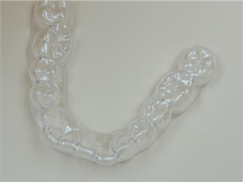 Clear Aligner Teeth Straightening